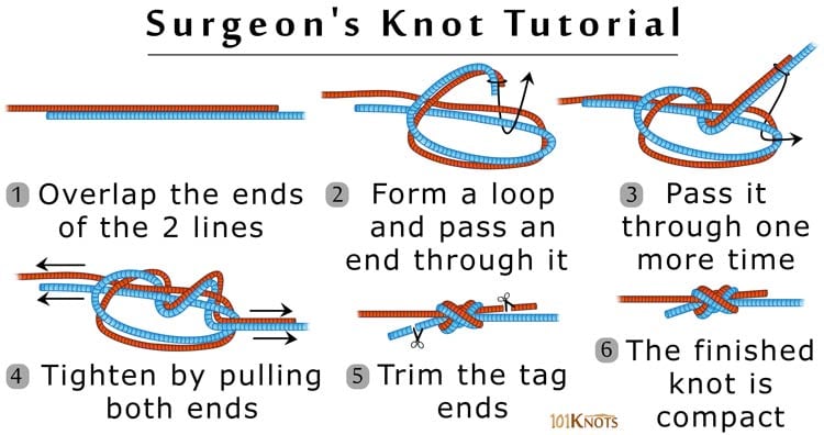 How to Tie a Surgeon's Knot? Tips, Video Instructions & Uses